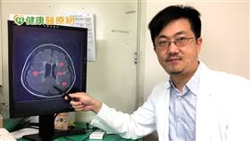 澄清醫院神經內科鄧浩文醫師表示，多發性硬化症的罹病高峰期正處人生黃金時期，恐因疾病影響人生規劃、事業及家庭。所幸，目前已有許多治療成效良好的選擇，可穩定控制疾病，如歐美日使用多年的口服藥物，台灣已有健保給付。