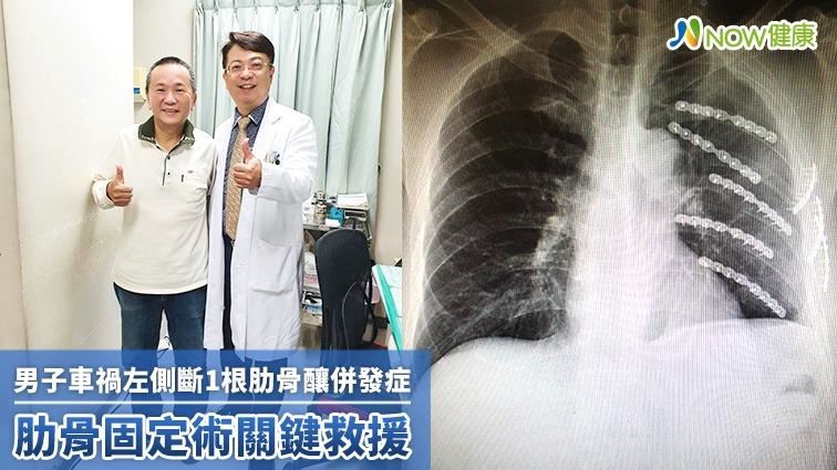 男子車禍左側斷1根肋骨釀併發症