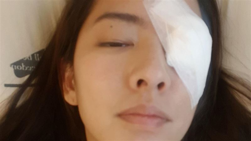 《與惡》女星遭重毆　送醫眼角膜破裂