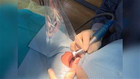 牙醫響應政府防疫政策  捐2.5萬組飛沫隔離罩