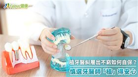 名家專用／NOW健康／侯植牙前應停看聽，除了優良植體、假牙，再加上醫師的專業與經驗環環相扣，植牙後應每半年定期回診1次，及早發現問題，防患於未然。(勿用)