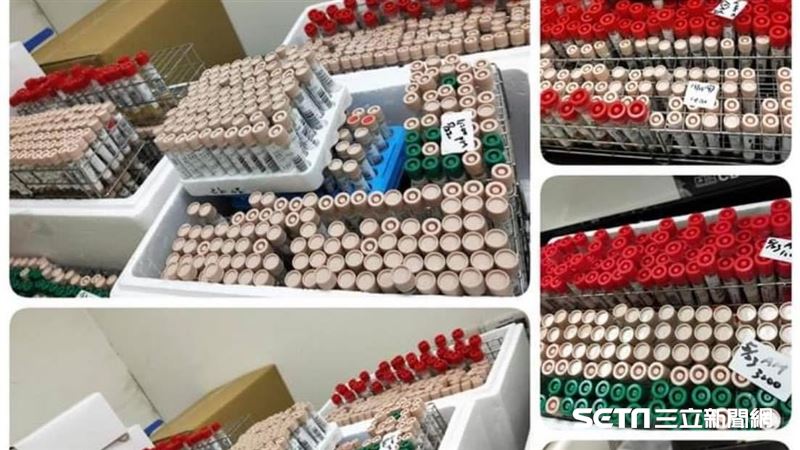 篩檢量有多驚人？醫檢師曝照片惹心疼