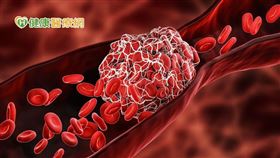 預防猝死除了要喝溫開水、多吃蔬菜和運動，使營養代謝好，讓血液中的濃度正常外，李深浦中醫師強調，服用中藥也很重要，而活絡血管的中藥可以疏肝排便，使血液中的油可以自然平衡。