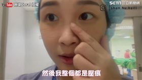 ▲珊瑚脫下N95口罩後臉上滿是壓痕（圖／珊瑚Coral 授權）
