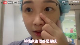 護理師曝防疫日常　脫下口罩滿是壓痕