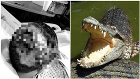 他被2.7公尺鱷魚咬一口 頭骨破裂打34根鋼釘驚悚畫面曝（圖／翻攝自Jeffrey Heim臉書、Pixabay）