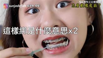 戴牙套崩潰的事　橡皮筋竟彈飛食物