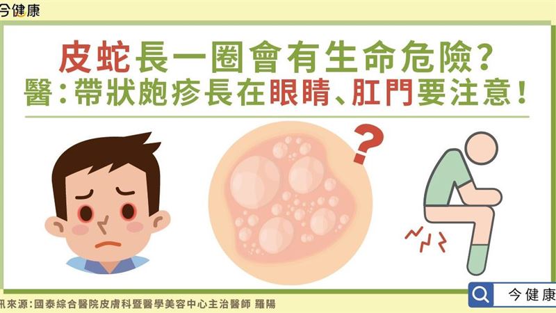 「帶狀皰疹」長在眼睛、肛門要注意！