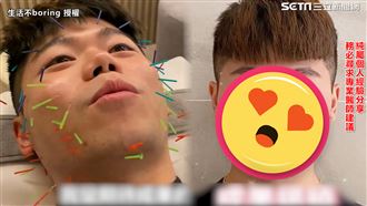 男體驗美容針灸　驚人結果曝光