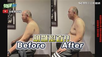 駝背阿北肩頸硬　整復師一喬明顯挺直