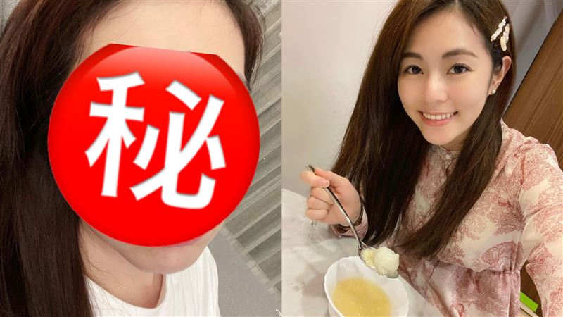 任容萱曬超腫針眼照　網激喊快看醫生