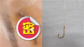 浙江,釣魚,魚鉤,倒鉤,眼皮,女友