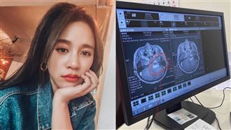 腫瘤太大「腦幹變形」女星吐療程心疼