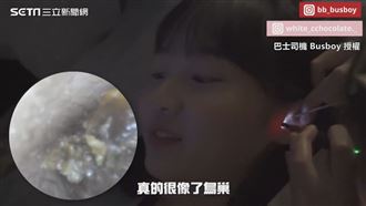 正妹體驗香港採耳　掏出巨大耳結石