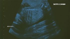 懷孕護理師救人染疫 