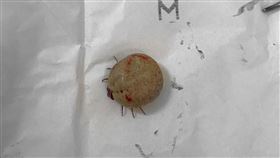 千萬不要抓！友人母遭蜱蟲寄生　長到「5元硬幣大」網嚇傻（圖／翻攝自爆廢公社）