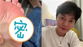 許富凱腳被割傷/經紀人提供