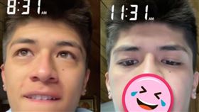  喬迪持續記錄自己嘴唇腫脹的情況，可以看到11點時，他的上唇已變成一條大香腸。（圖／翻攝自喬迪抖音）