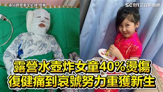 女童40%燙傷　復健哀號努力獲重生