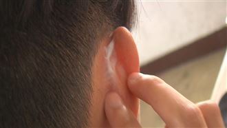 戴口罩長期磨耳　竟惡化蜂窩性組織炎
