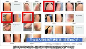 翻攝自蘇啟成醫師新冠手臂影片