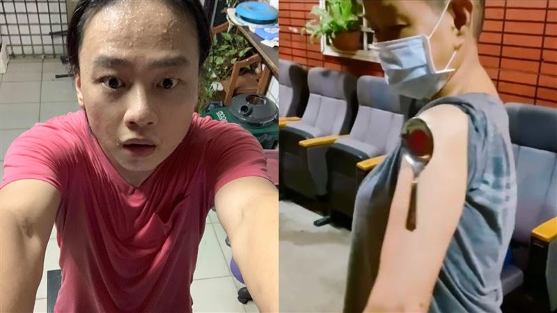莫德納手臂？男星媽「發功」吸鐵湯匙