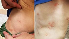 許志煌,禽蟎,跳蚤,冷氣（許志煌授權提供）