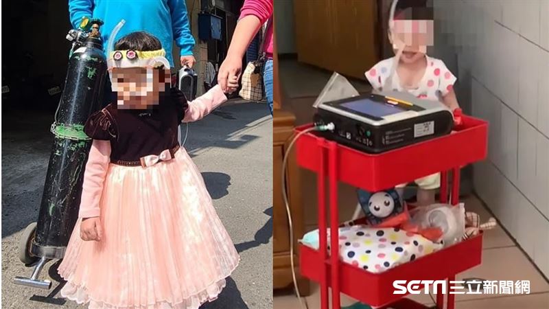 無法自己呼吸…患罕見基因異常呼吸窘迫症　3歲女童等換肺 | 生活 | 三立新聞網 SETN.COM - Vimarsana News