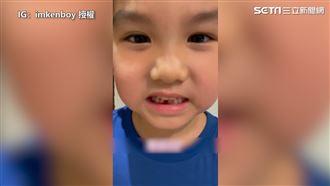 底迪線綁牙齒　大力關門拔牙燦笑成果