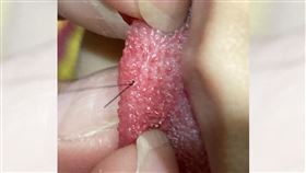 頭髮,舌乳頭,打結,舌頭,姪女（圖／翻攝自爆廢公社二館）