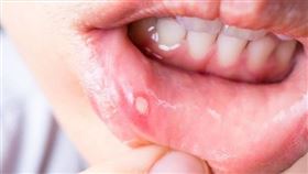 嘴破（圖／World Gym Blog提供）