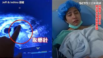 人妻求子忍痛做試管　長針取卵畫面曝