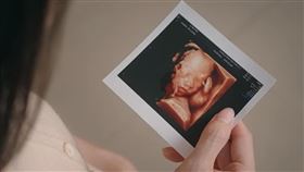 先天顱顏缺陷／羅慧夫顱顏基金會授權提供