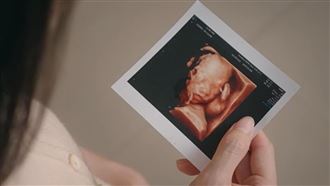 懷上唇顎裂孩子　她煎熬：該不該生？