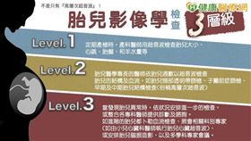 胎兒影像學檢查，可以分成Level 1, 2, 3三個層級。