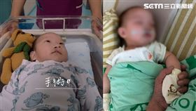 5月大男嬰動手術／羅慧夫顱顏基金會授權提供