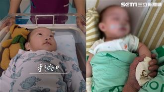 5M大寶寶動手術　父牽他小手求順利