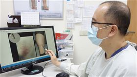 大林慈濟醫院整形外科醫師許宏達發現，近日有不少人不幸被毒蟲「紋身」，導致皮膚起水泡、潰爛（圖／大林慈院提供）