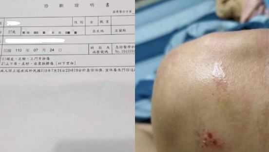 不爽被勸戴口罩　男衝加油站毆女員工