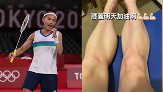 史詩級救球撲倒！戴資穎曝膝蓋受傷照