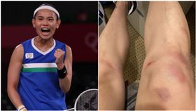  戴資穎,膝蓋,小腿,羽球,奧運(翻攝自 戴資穎 IG、體育署提供