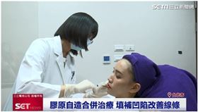 曜亞坡尿酸(業配勿用)