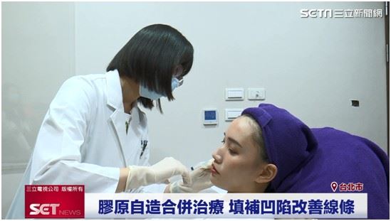 拒絕塑膠臉　膠原自造澎潤更自然