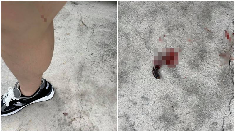 見吸血蟲猛咬腿後倒地吐血　網曝真相