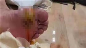 中國,諶龍,羽球,銀牌,受傷,腳（圖／翻攝北京新浪體育）