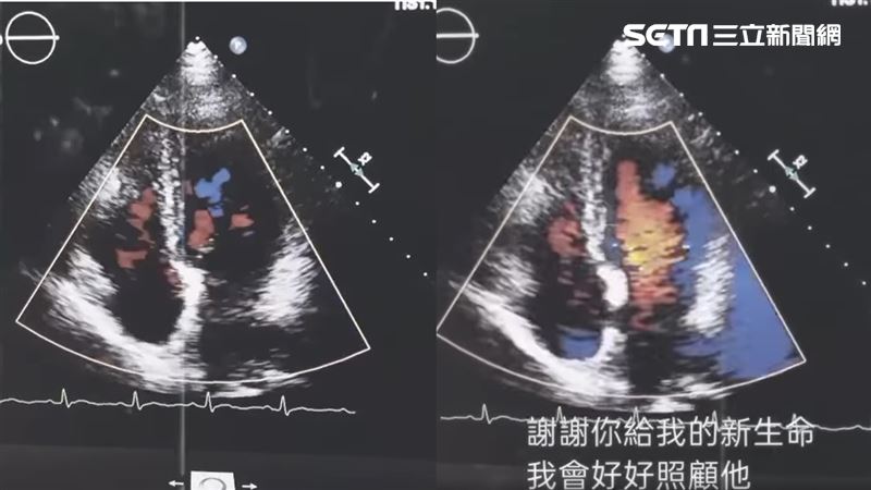 兒器捐2年　母收到心跳聲淚：他還在