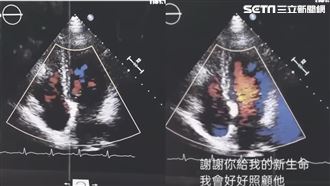 兒器捐2年　母收到心跳聲淚：他還在