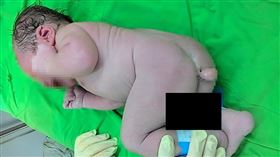 嬰兒長尾巴（圖／翻攝自施景中醫師臉書）