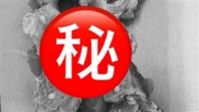 有女患者的子宮肌瘤顆數，竟如「芝麻」般多。（圖／李偉浩醫師授權提供）