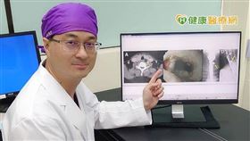 進行食道憩室或甲狀腺切除手術時，建議搭配返喉神經監測儀，保留返喉神經功能，避免傷及神經。